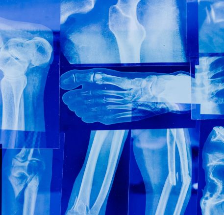 Detailed collage of human bone x-rays illustrating various skeletal parts in blue tonality.